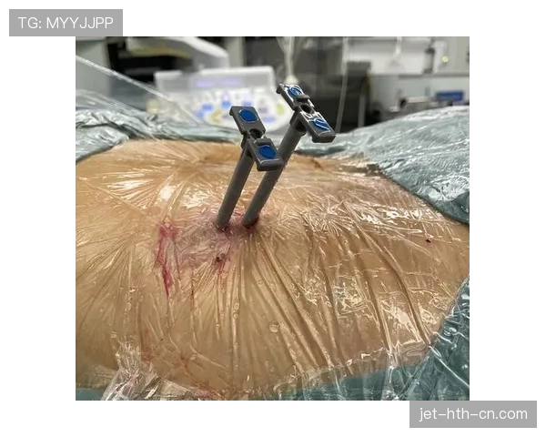 罗伯逊与阿劳霍在边路推进中出现结构分散趋势 罗伯逊与阿劳霍在边路推进中出现结构分散趋势